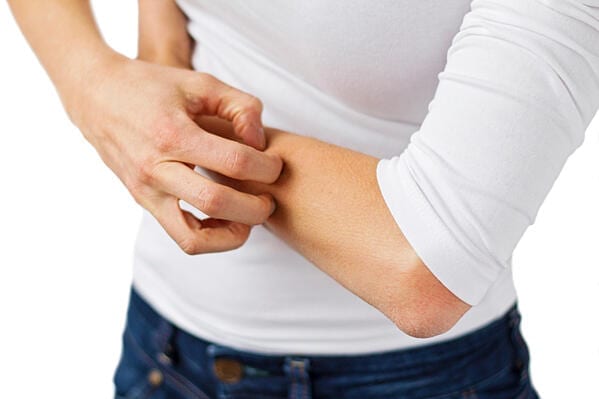 Dr. Yogen Dave, Allergy & Asthma specialist at Advanced Specialty Care, explains how to identify Hives and how the condition is typically treated.
