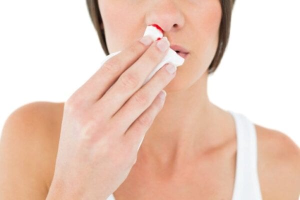 What Causes Nosebleeds